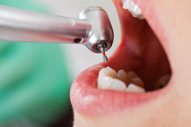 Best Emergency Care for Gum Disease in Oyster Creek, TX